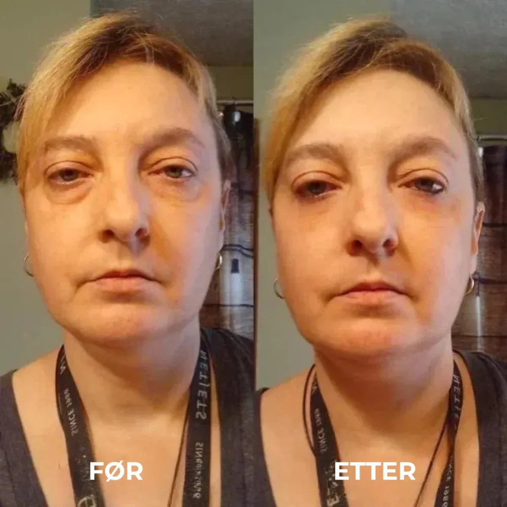 EyeGlow™ | Kollagen hydrogel øyepatcher